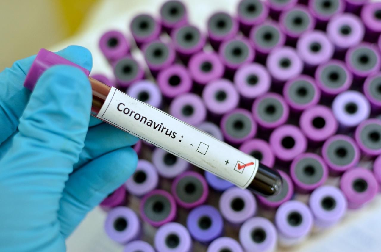 Nigeria Confirms Second Case Of Coronavirus