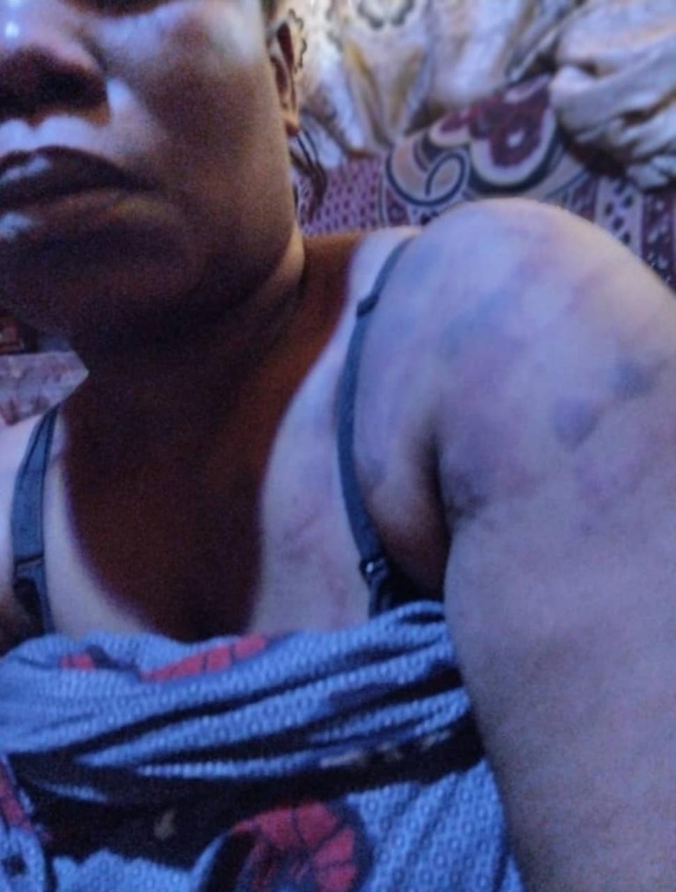 Nigerian Woman Bails Abusive Unemployed Husband That Beat Her To A Pulp (Photos)